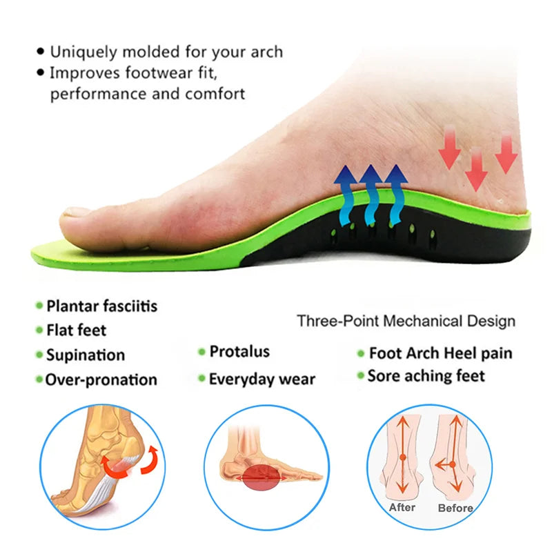 EVA Orthopedic Shoes Sole Insoles For feet Arch Foot Pad X/O Type Leg Flat Foot Elastic Shock Absorption Comfortable Insoles